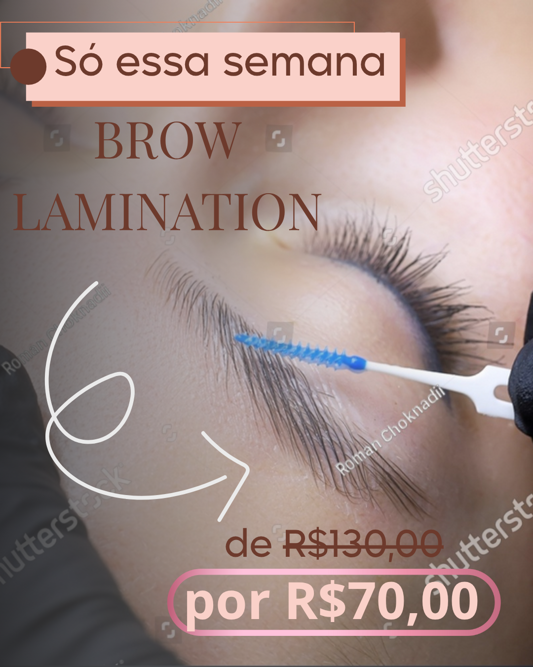 Post Promoção